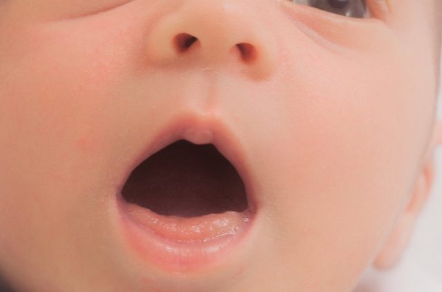 【赤ちゃん】口の中に起きる病気がヤバい件～この白いものは何？～